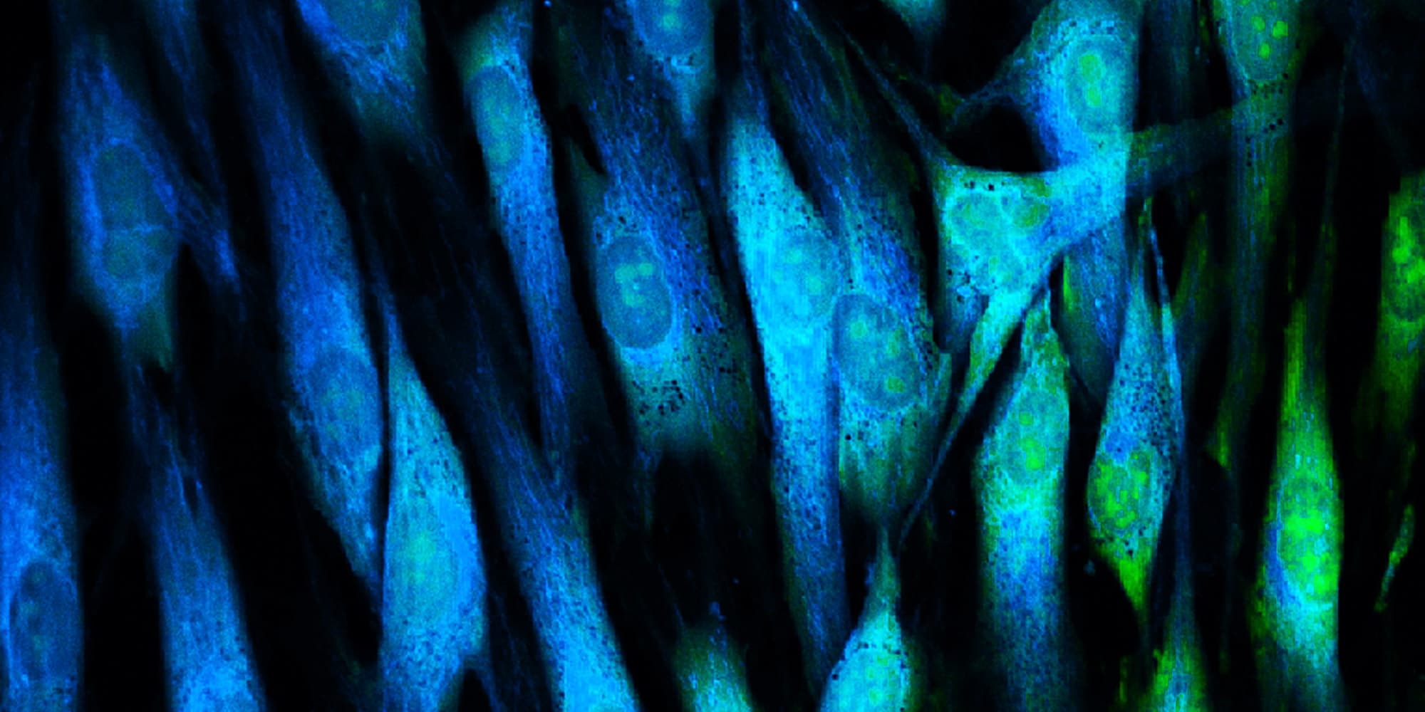 fluorescentiemicroscoop imec