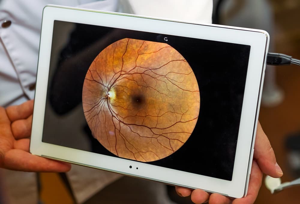 imec article Retina