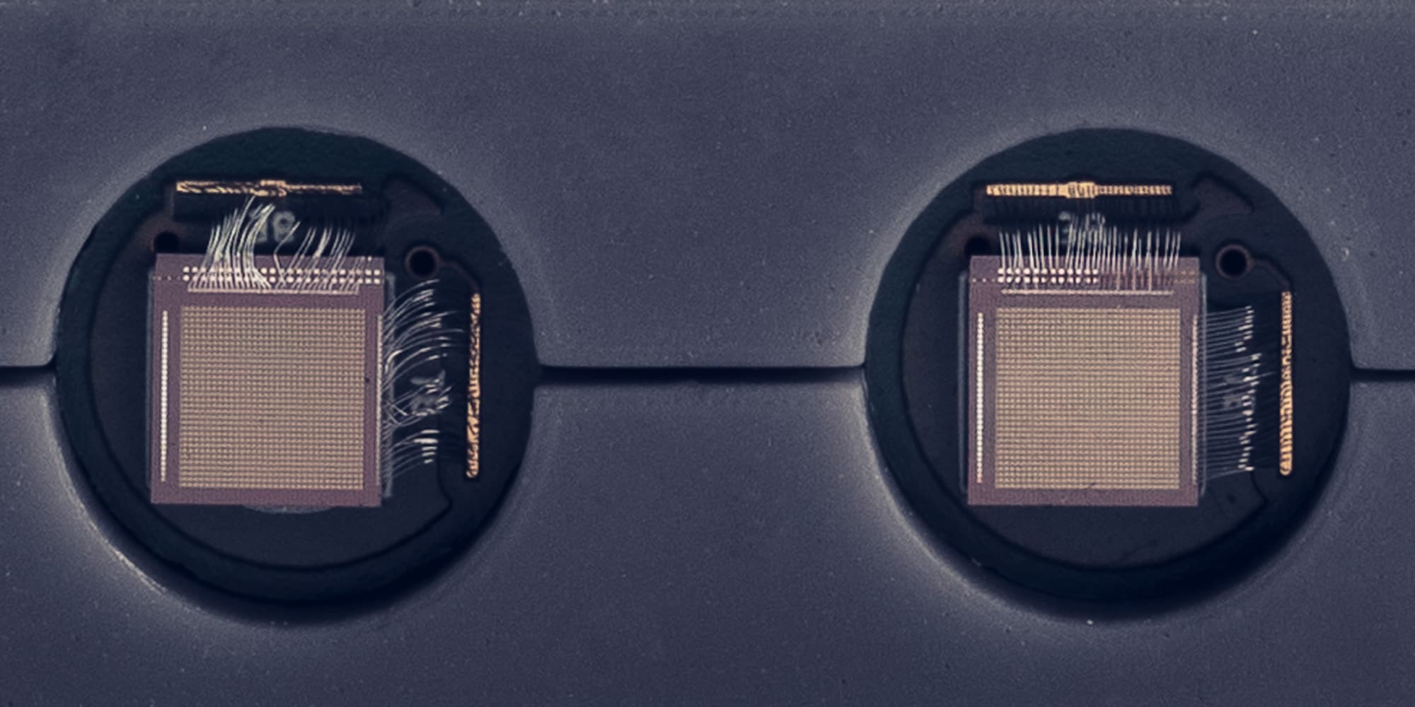 Nieuwe methode gebaseerd op echografie bepaalt accuratere bloeddrukwaardes