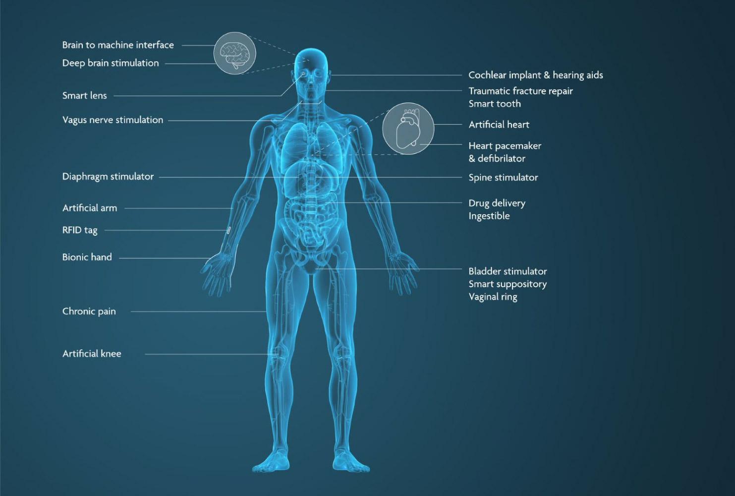 Mogelijke toepassingen voor medische implantaten.